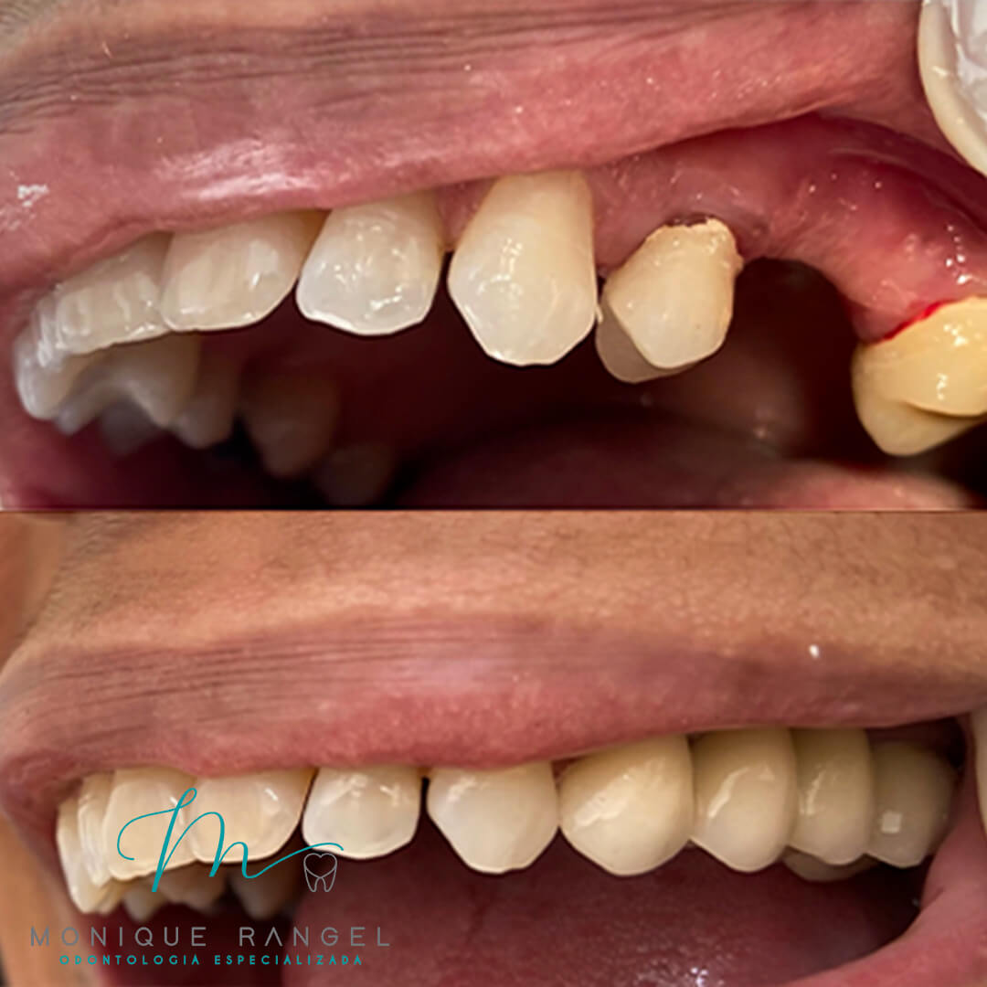 PROCEDIMENTO---LOGO-ALTERADO T