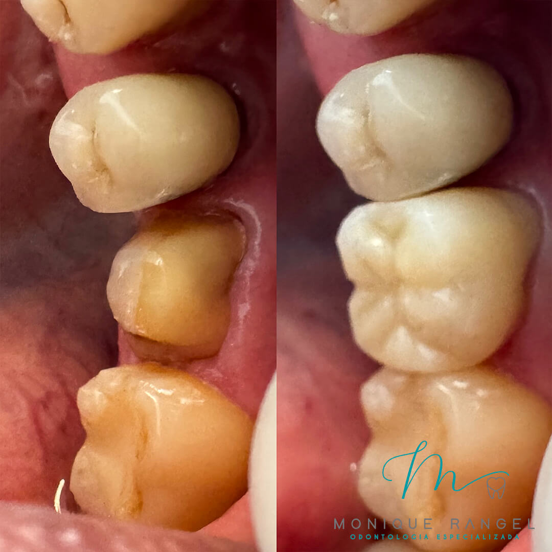 PROCEDIMENTOS-001-03