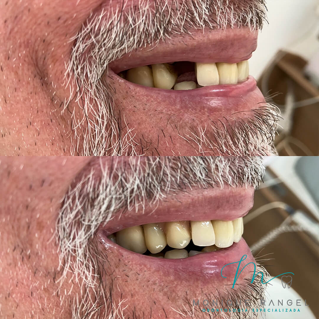 PROCEDIMENTOS-001-05