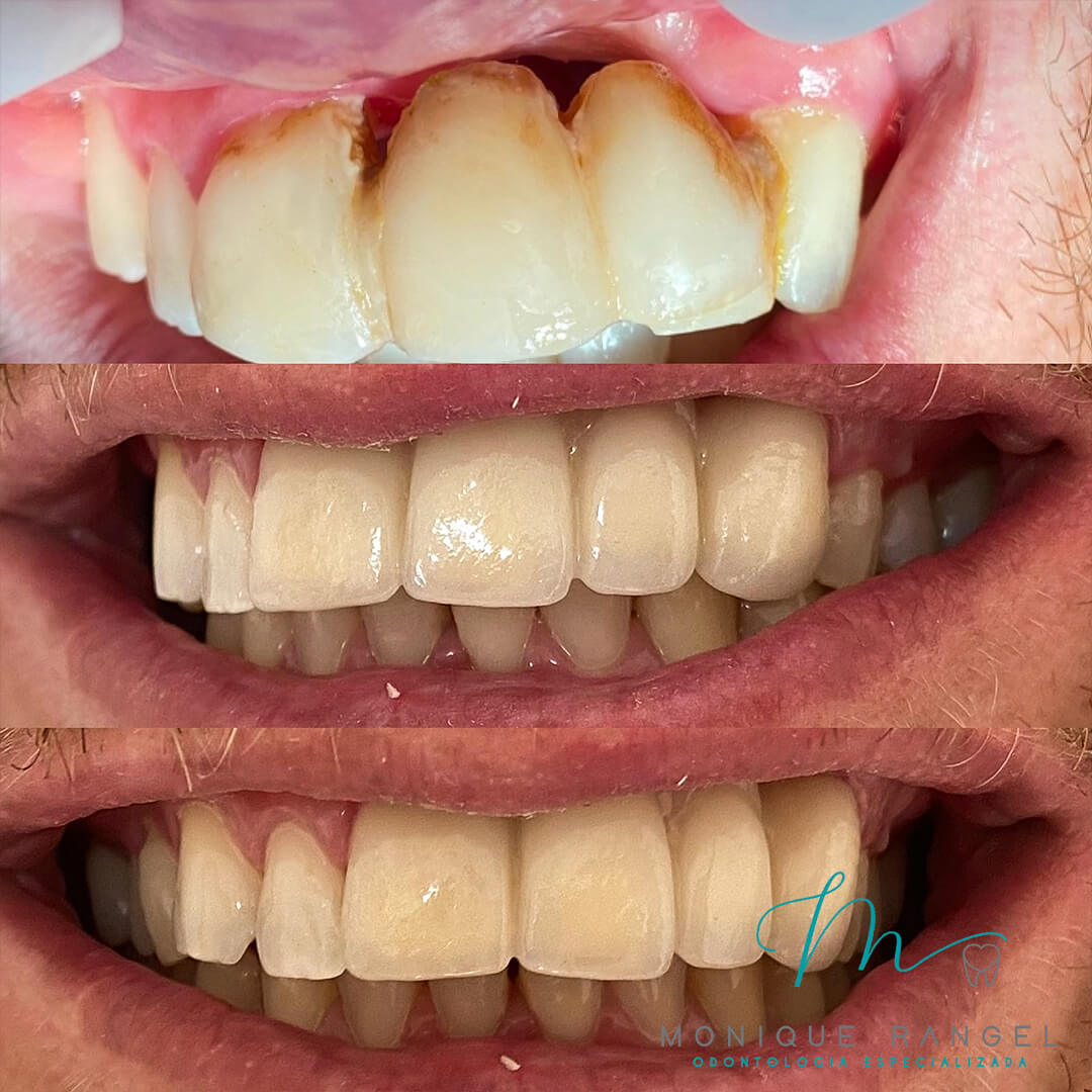 PROCEDIMENTOS-001-07