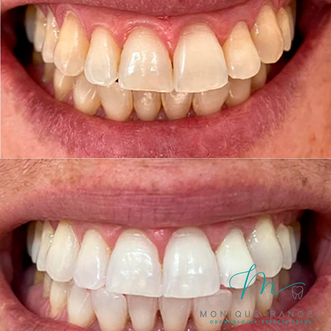 PROCEDIMENTOS-001-09