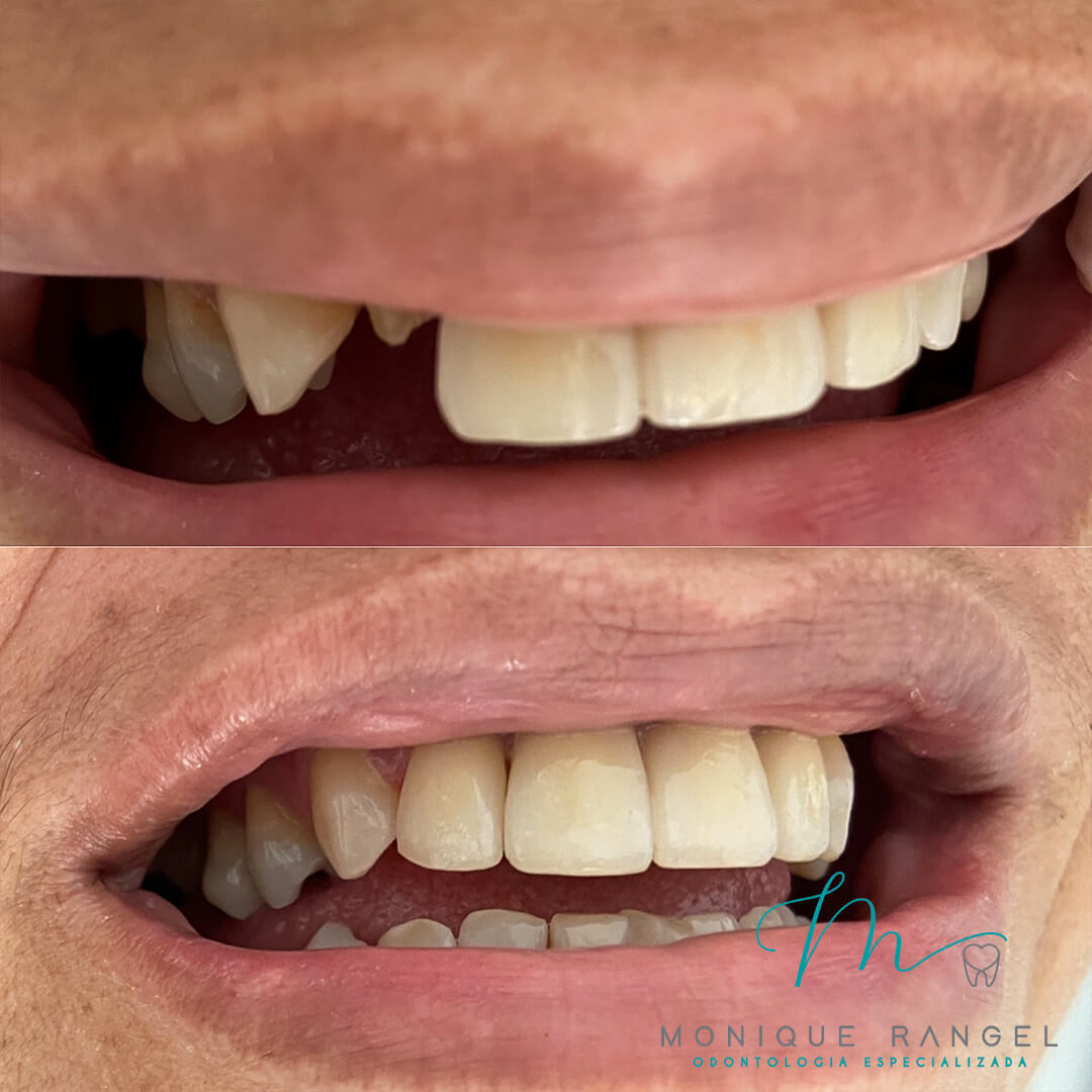 PROCEDIMENTOS-001-10