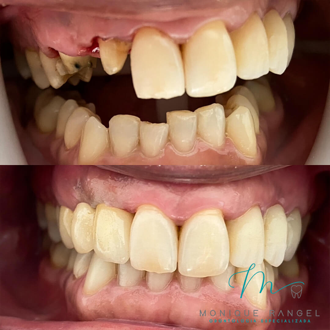 PROCEDIMENTOS-001-12