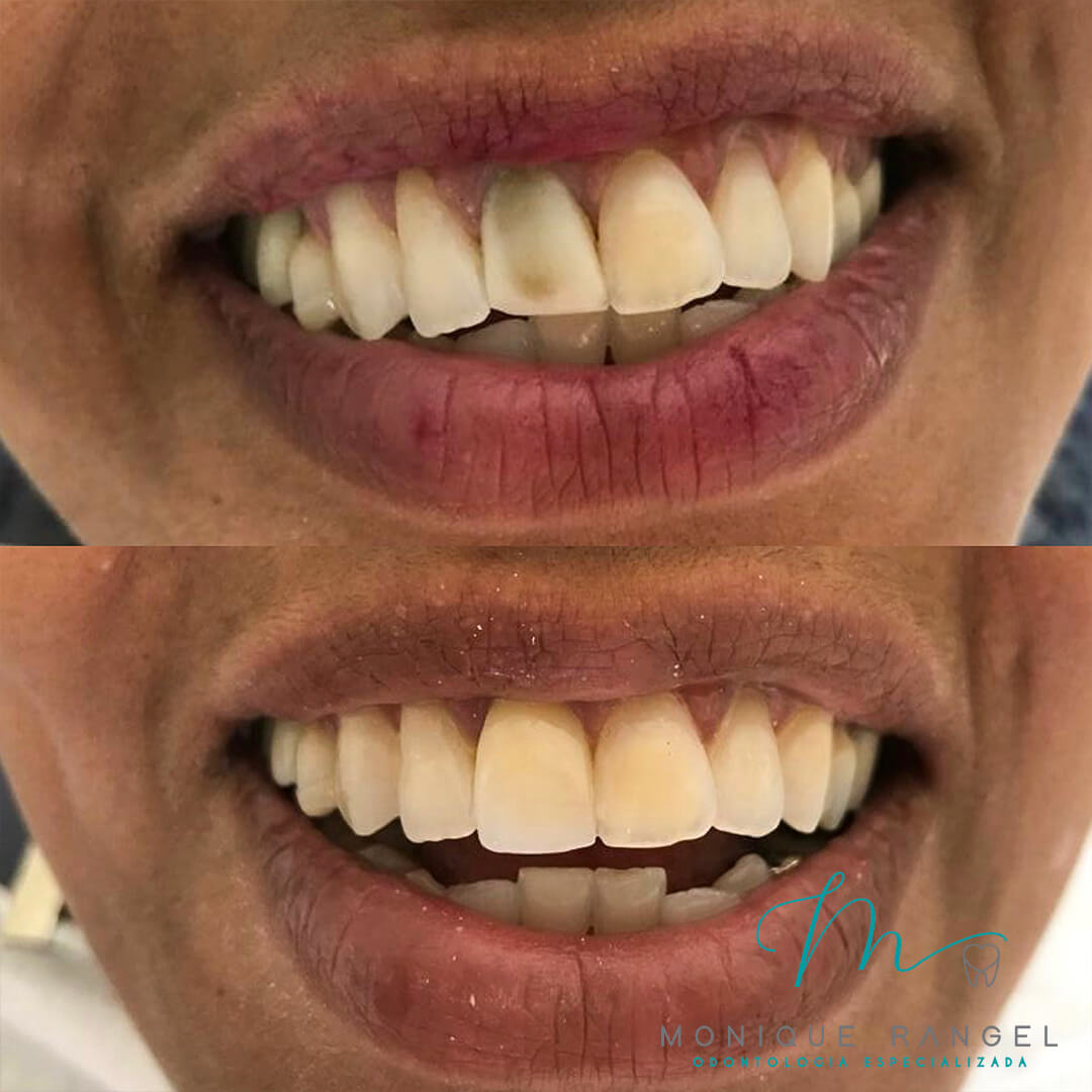 PROCEDIMENTOS-001-13