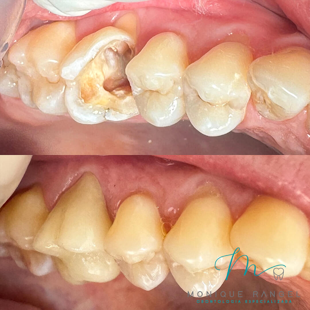 PROCEDIMENTOS-001-14