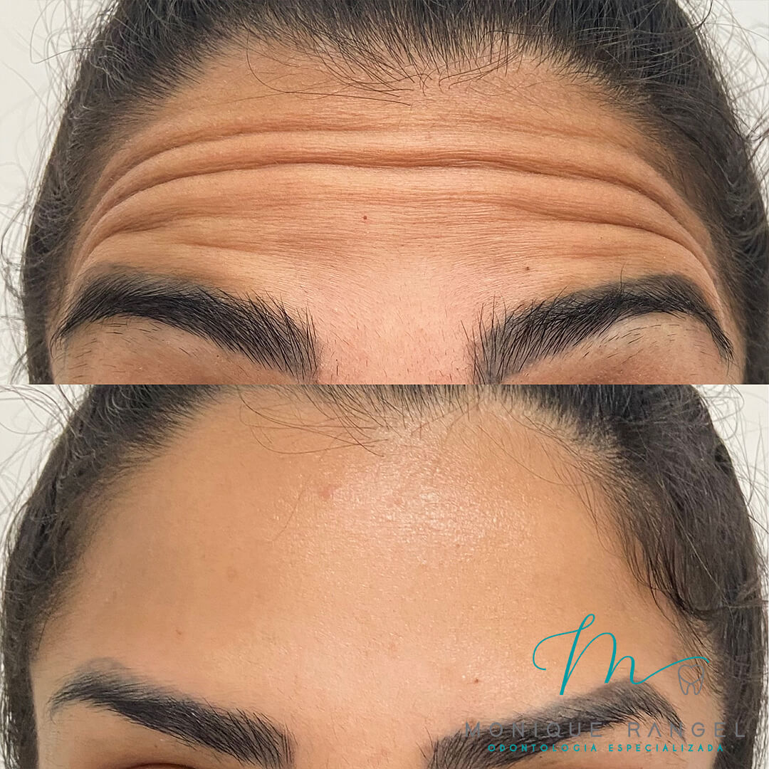 PROCEDIMENTOS-001-15-1