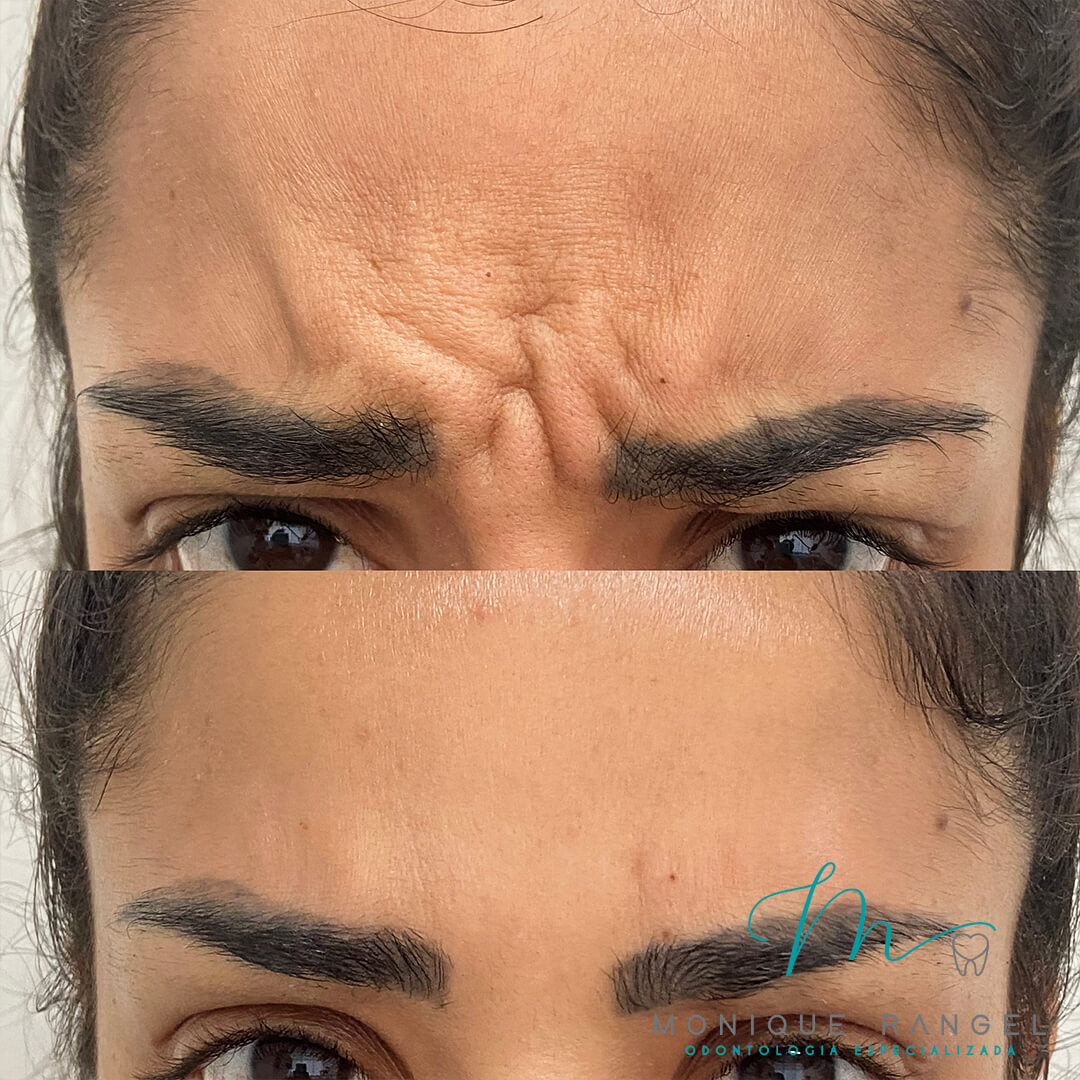 PROCEDIMENTOS-001-15-2