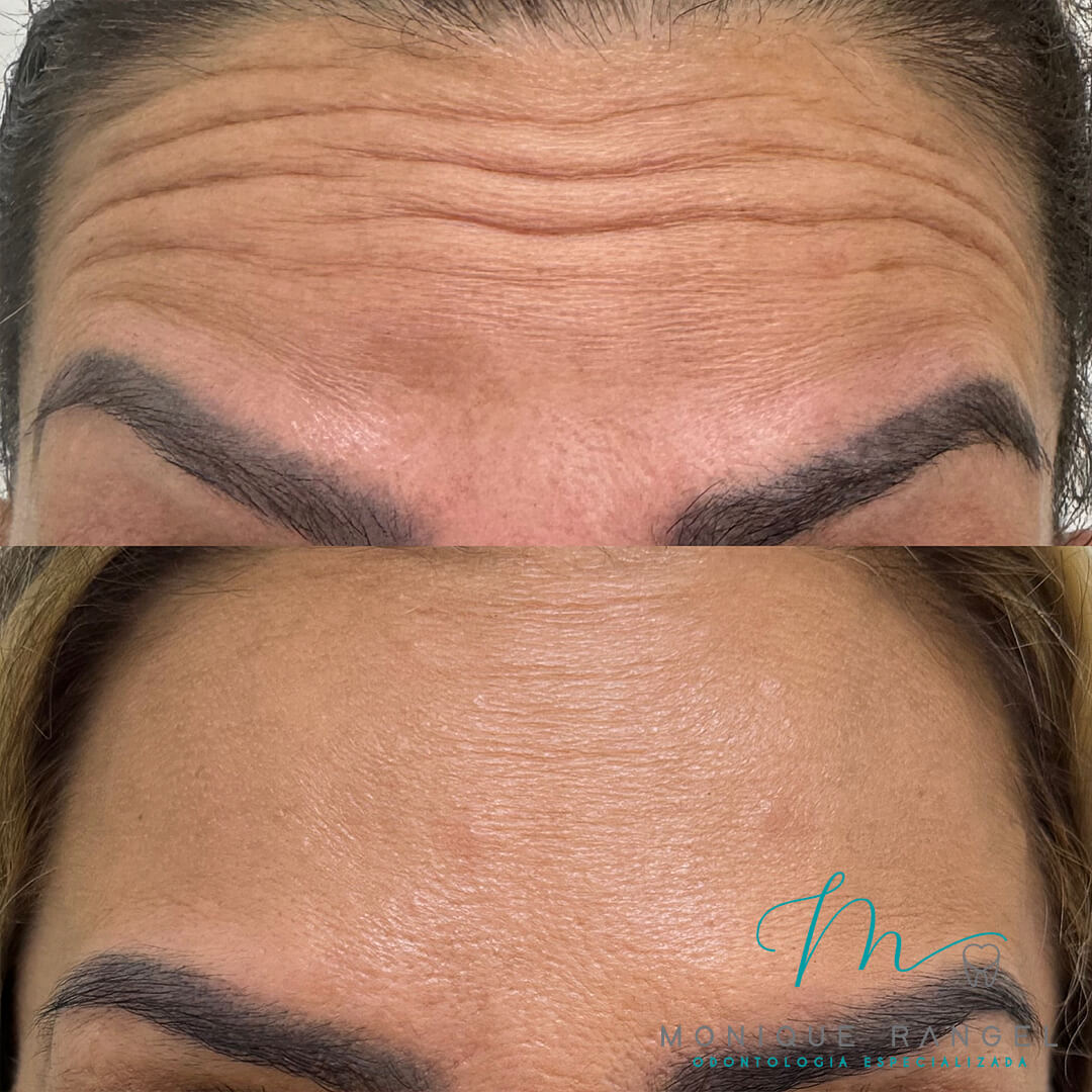 PROCEDIMENTOS-001-15