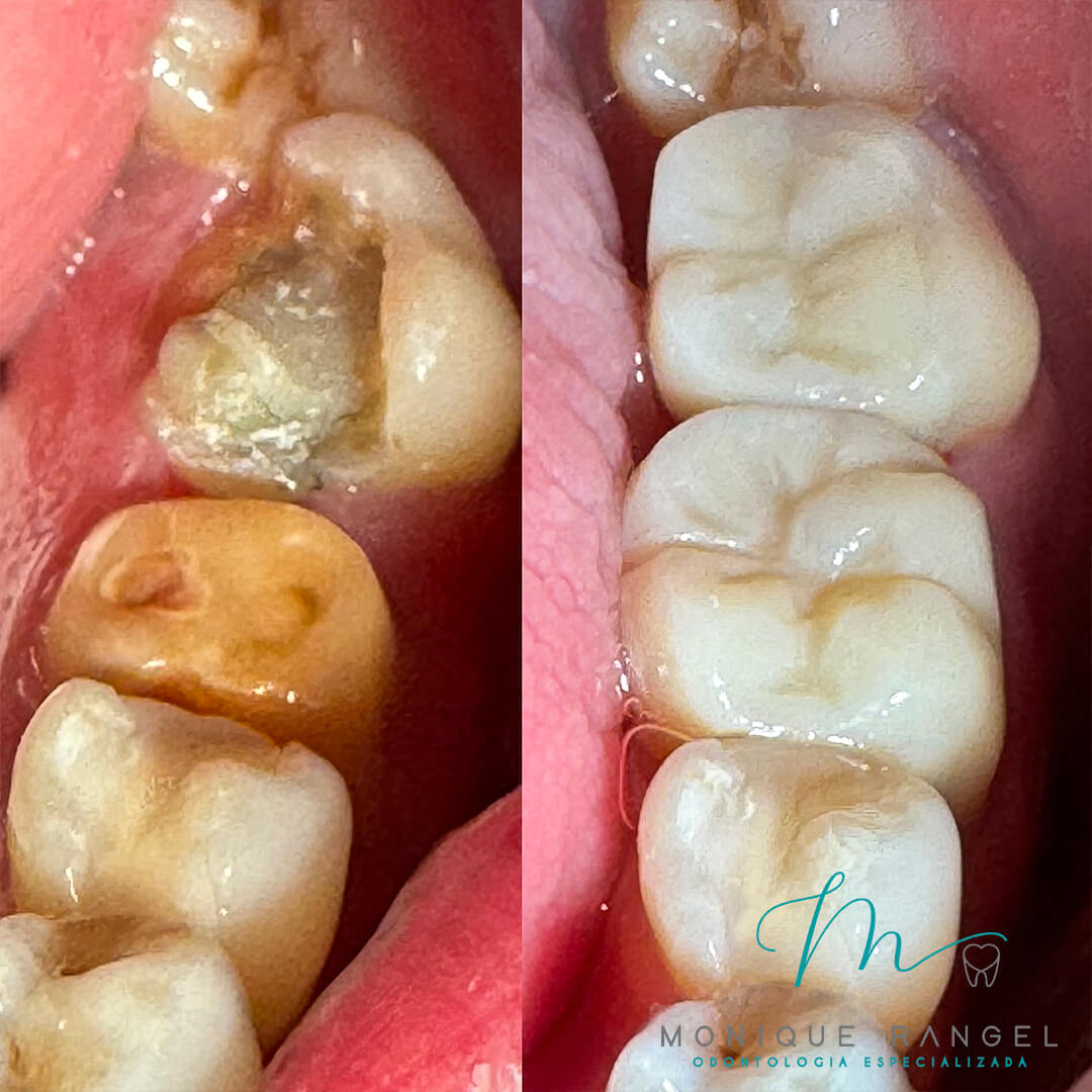 PROCEDIMENTOS-001-16