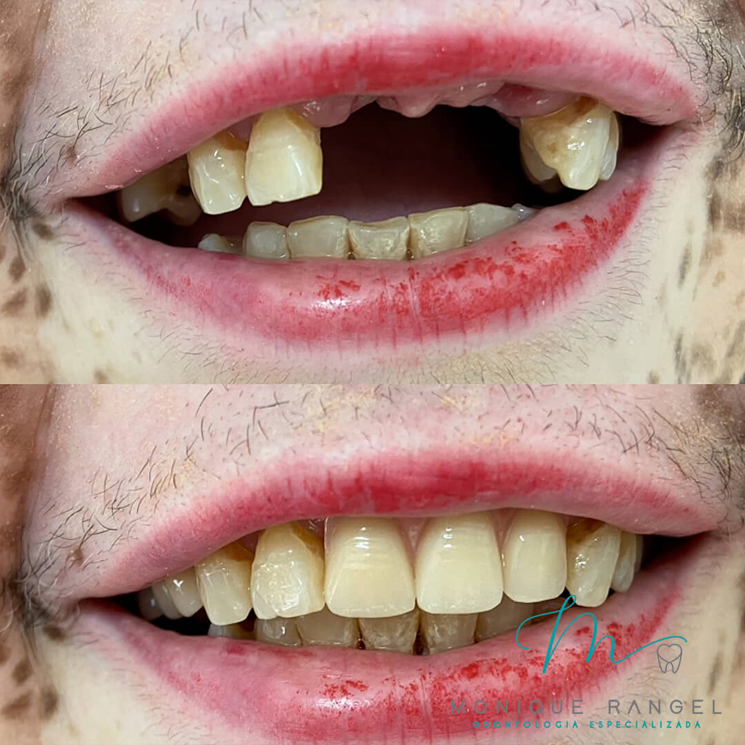 PROCEDIMENTOS-001-17