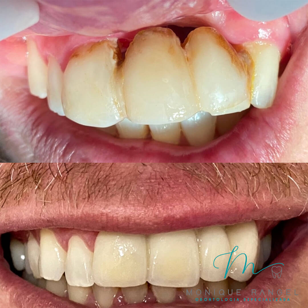 PROCEDIMENTOS-001-18